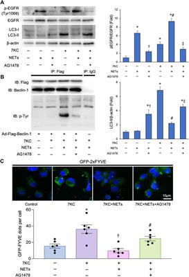 Neutrophil extracellular traps-mediated Beclin-1 suppression aggravates atherosclerosis by inhibiting macrophage autophagy